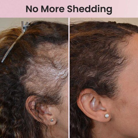 HairLux image