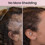 HairLux image