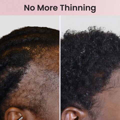 HairLux image