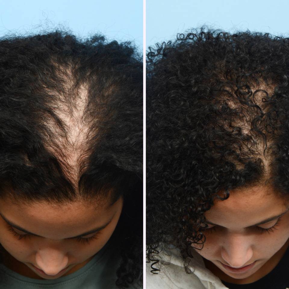 HairLux image